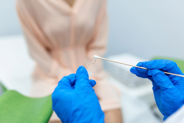 Understanding Pap Smear Results: What They Mean